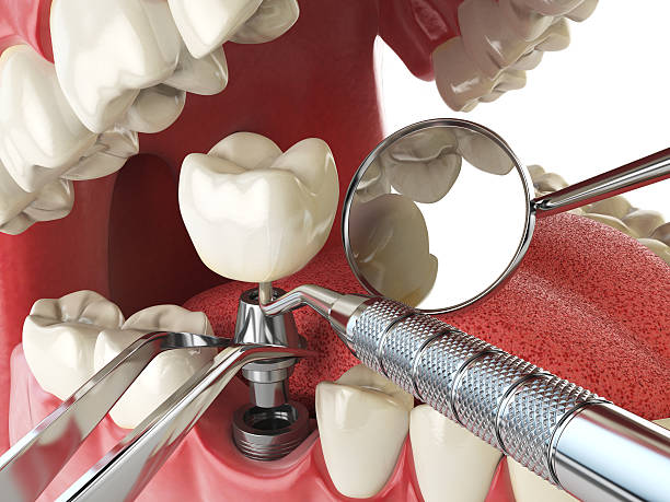 Best Emergency Dental Services for Seniors in Port Salerno, FL